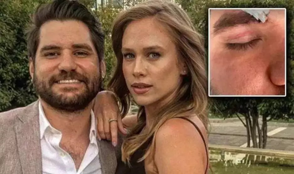 Ceyhun Fersoy Kimdir, Ka&ccedil; Yaşında, Nereli? Eşi Beg&uuml;m &Ouml;ner Kimdir, Ka&ccedil; Aylık Hamile? Neden G&uuml;ndem Oldu?