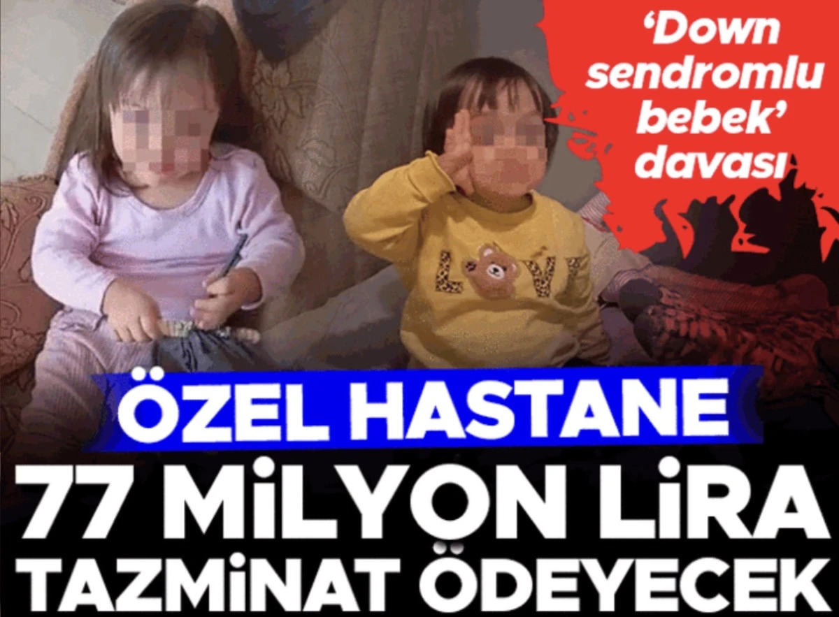 Down sendromlu bebek davası: 700 bin lira &ouml;demeyi reddeden hastane 77 milyon lira tazminat &ouml;deyecek