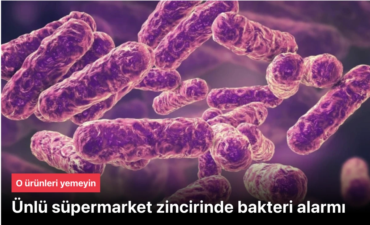 Sainsbury’s skandalı! Süpermarket zinciri Sainsbury’s'nde bakteri alarmı